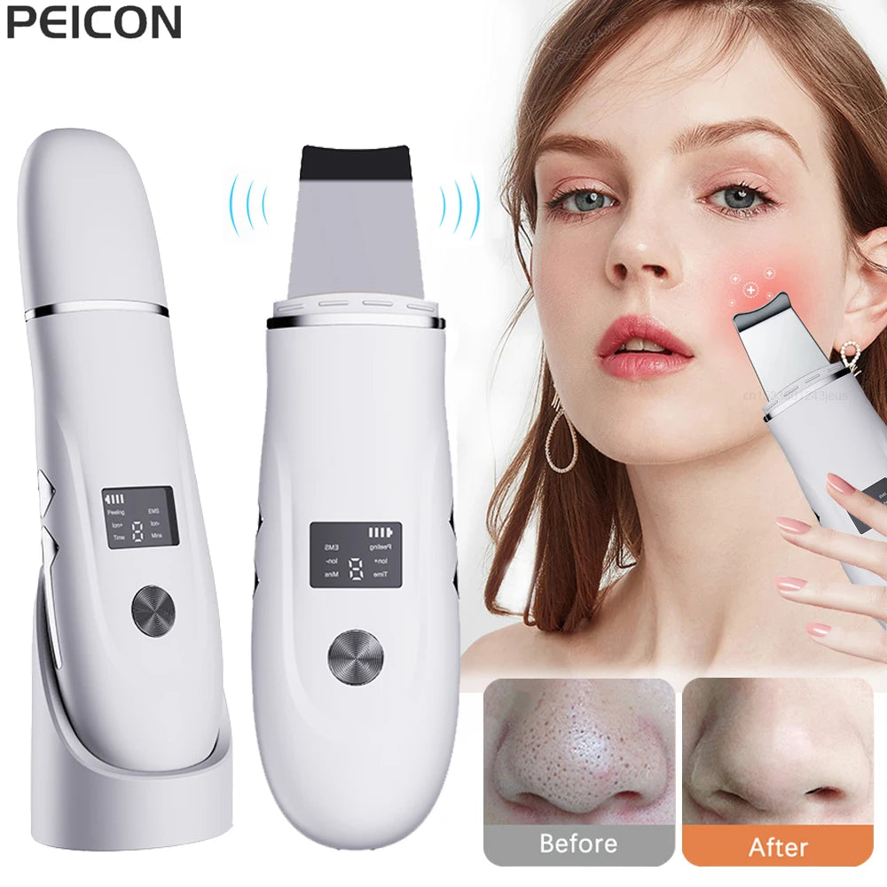 Nettoyeur de Peau Ultrasonique 3-en-1 – Points Noirs, Nettoyage Profond & Massage Liftant
