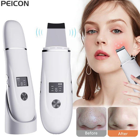 Nettoyeur de Peau Ultrasonique 3-en-1 – Points Noirs, Nettoyage Profond & Massage Liftant