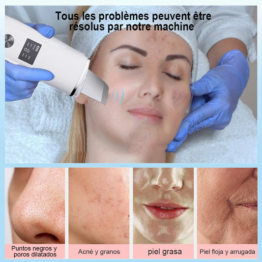 Nettoyeur de Peau Ultrasonique 3-en-1 – Points Noirs, Nettoyage Profond & Massage Liftant